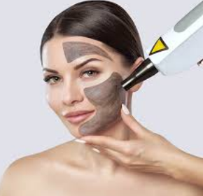 Carbon Laser Facial Image