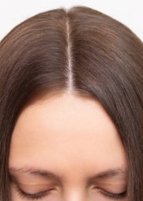 Hair Fall Information