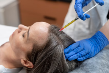 Hair Mesotherapy Session