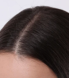 After Scalp Treatment