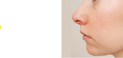 After Rosacea Treatment