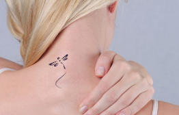 Before Tattoo Removal