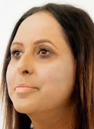 After Vitiligo Treatment